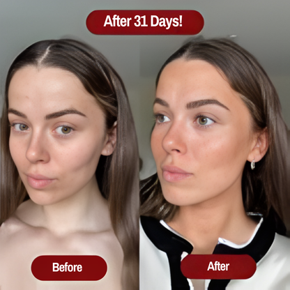 Astaxanthin Soft Gels